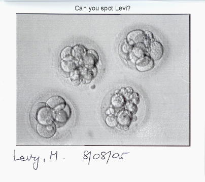 Aug 8 Four Cells 2 Days Old